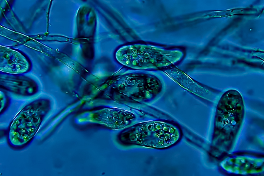 藻藍(lán)蛋白抗癌征途：物理雙法掃清障礙，賦能精準(zhǔn)出擊